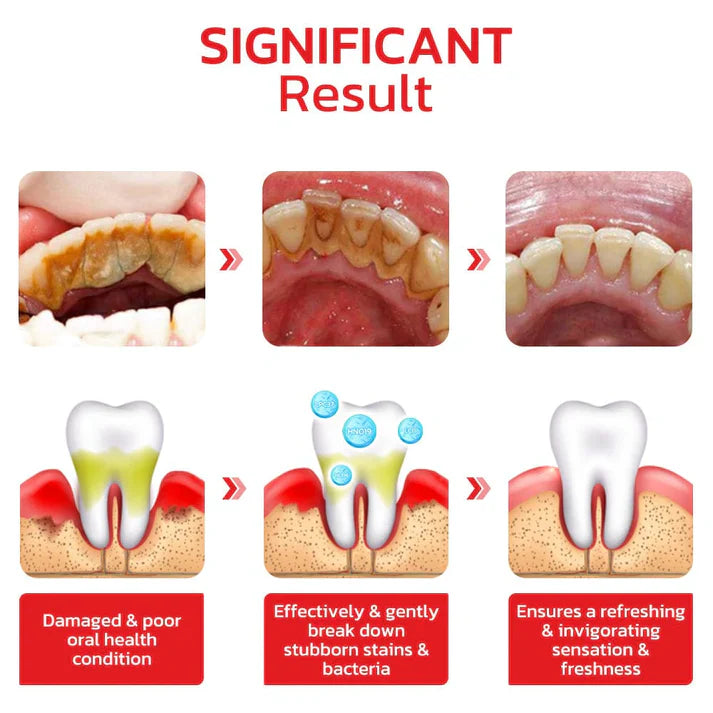 SP-4 Ultra+ Whitening Teeth 🔥Flat 50% Off🔥