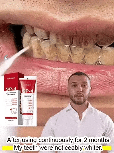 SP-4 Ultra+ Whitening Teeth 🔥Flat 50% Off🔥